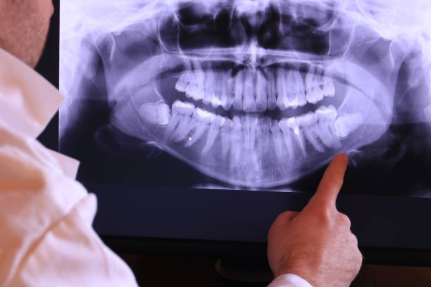 Best Emergency Dentist for Knocked-Out Tooth in Sawmills, NC