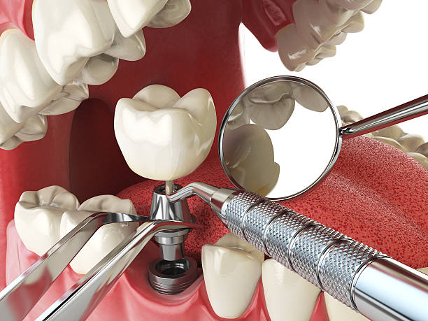 Best Pediatric Emergency Dentist in Sawmills, NC